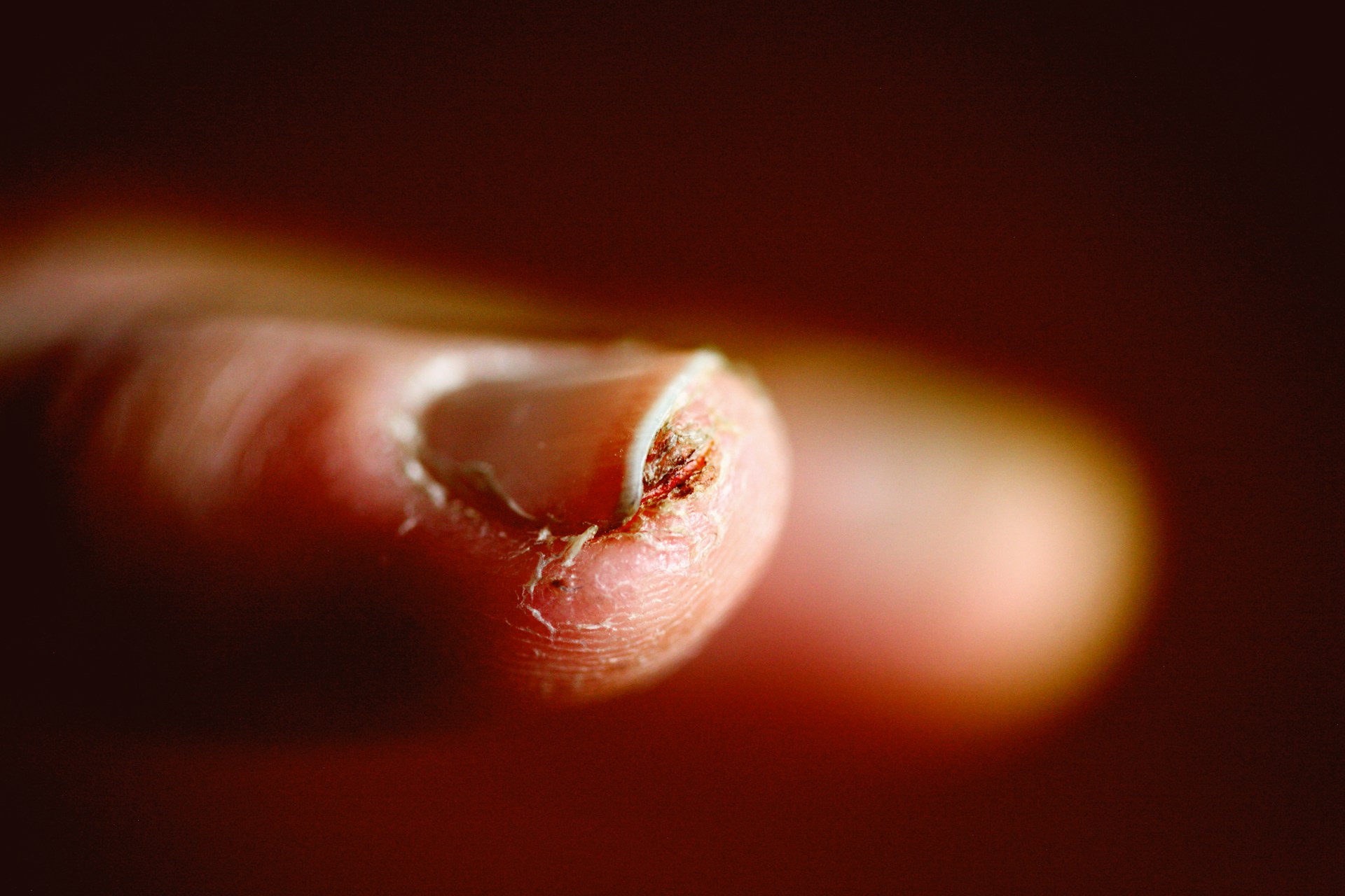 What Do Your Fingernails Say About Your Health